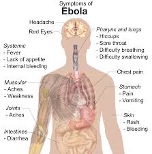 UTMB researchers develop Ebola vaccine effective in a single dose